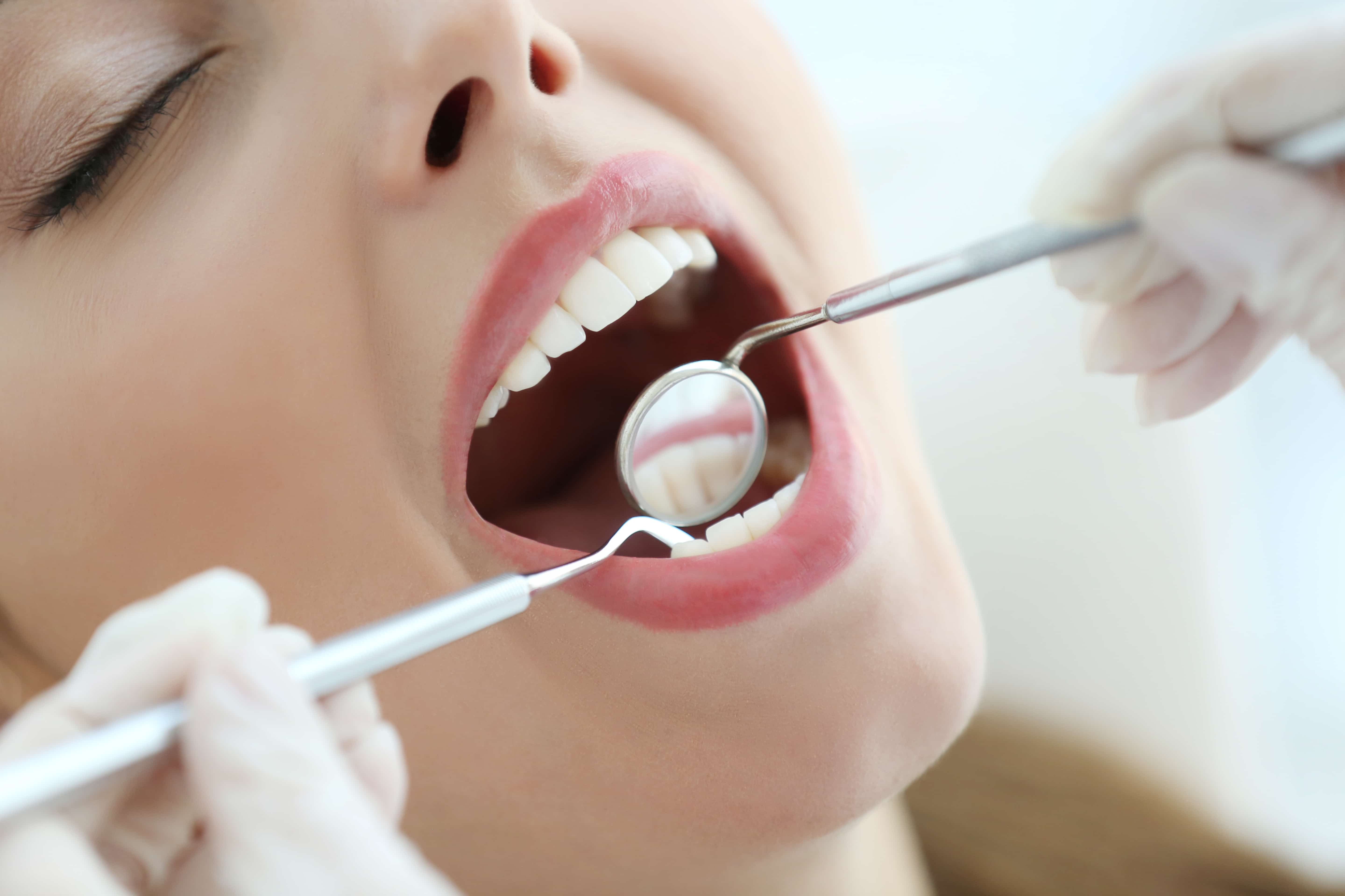 Полость рта для стоматолога. Осмотр стоматолога. Осмотр зубов у стоматолога. Профессиональная гигиена полости рта. Осмотр полости рта у стоматолога.