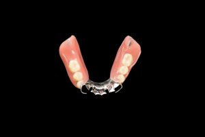 celina partial dentures