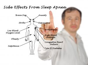 celina sleep apnea