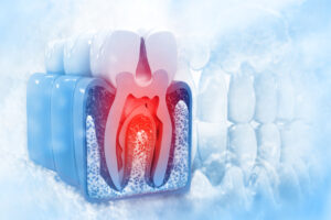 celina root canal