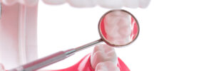 celina tooth extraction