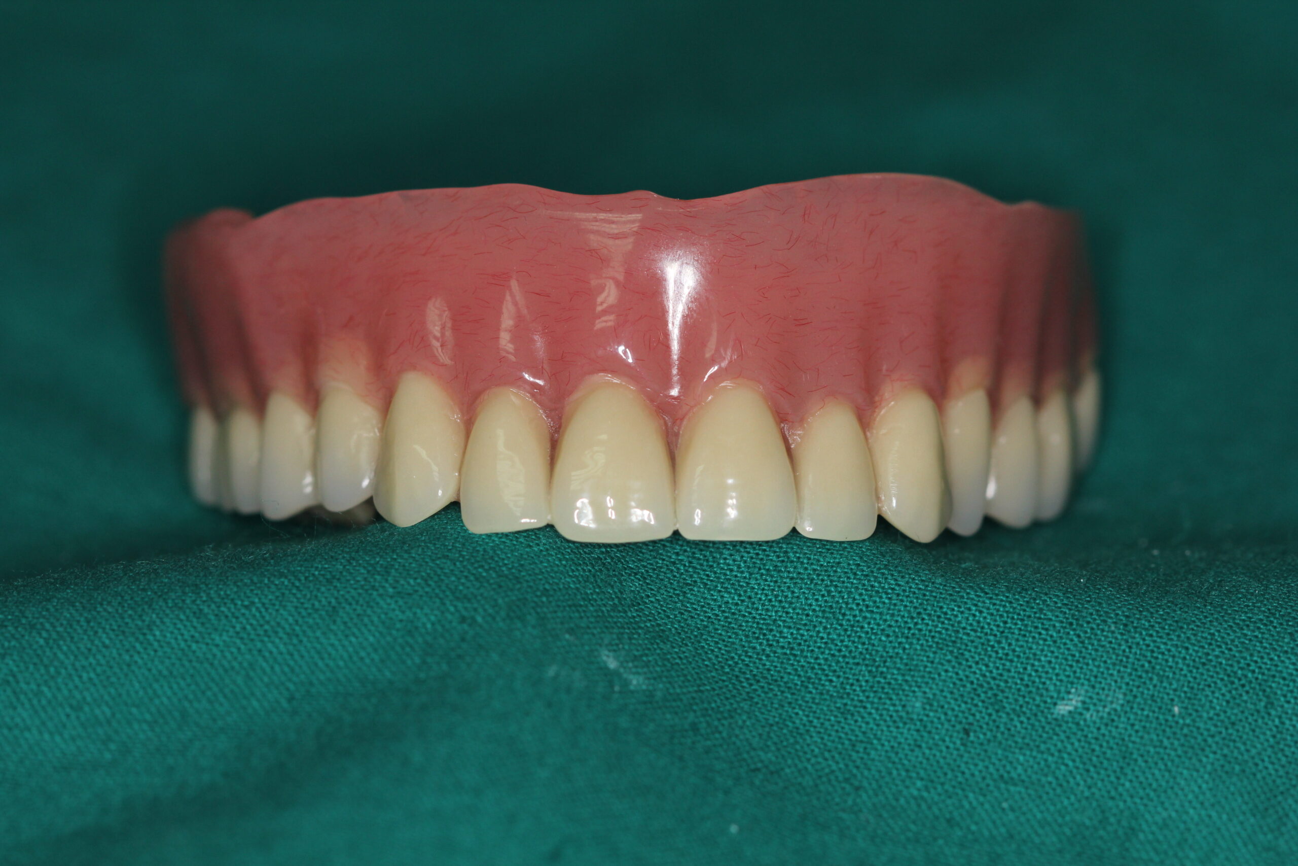 full-dentures-mean-better-smiles-celina-tx