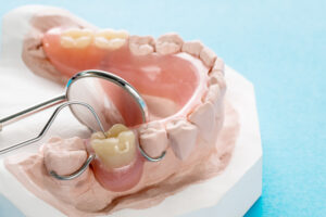 celina partial dentures