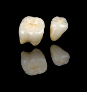 celina dental crowns