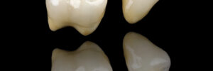 celina dental crowns