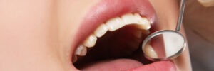 celina preventive dentistry