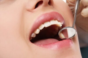 celina preventive dentistry