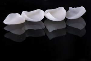 celina veneers