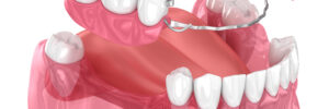 celina dentures