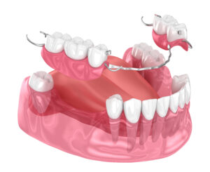 celina dentures