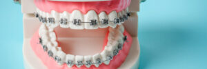 celina orthodontics