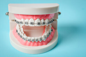celina orthodontics