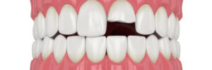 celina restorative dentistry