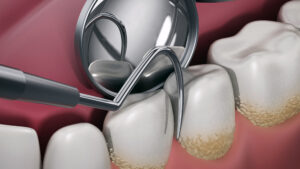 celina general dentistry