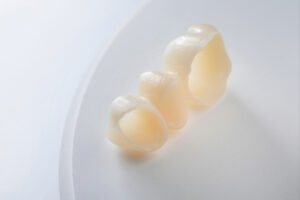 celina dental bridge
