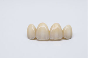 celina crowns