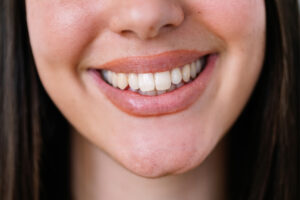 celina periodontal care