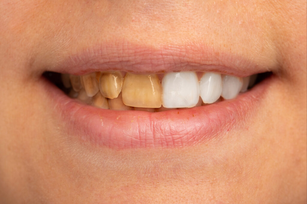 celina cosmetic dentistry