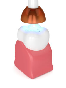 celina filling