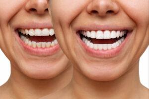 celina cosmetic dentistry
