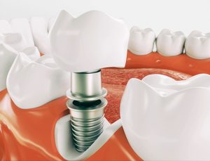 celina oral surgery 